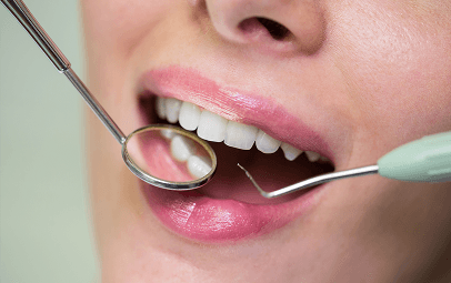 Close-up of a dental check-up with mirror and probe