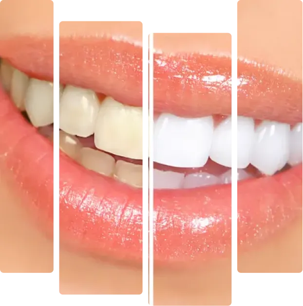 treatment-banner