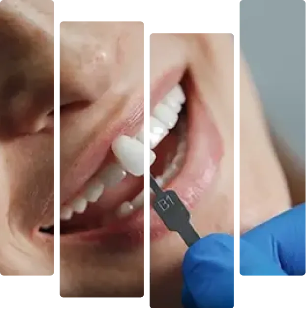 treatment-banner